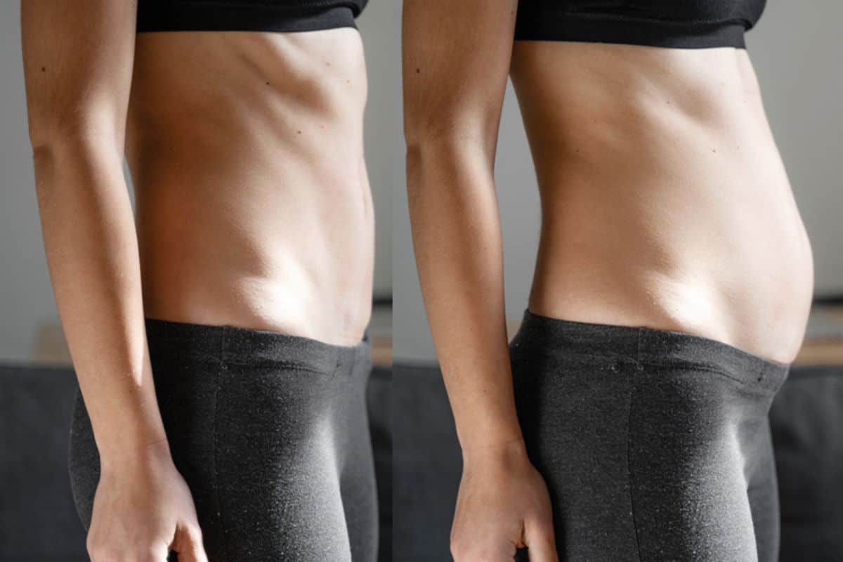 How long does diastasis recti take to improve Kensal Town?