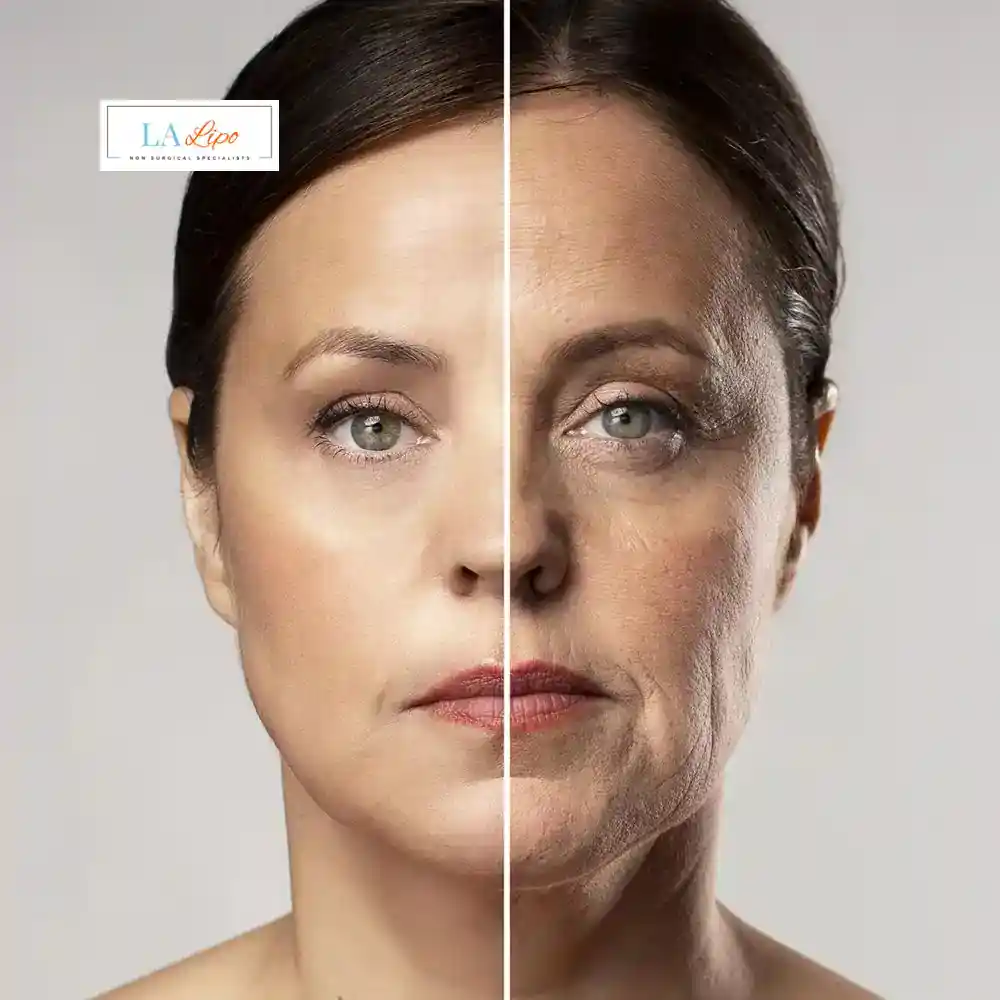 How Can You Tell If Non-Surgical Skin Tightening Is Right for You Kensal Town?